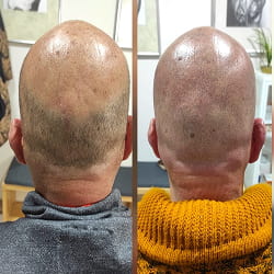 Tattoo micropigmentación